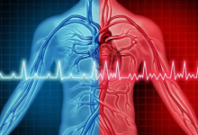 صورة “فحص بسيط” يرصد مخاطر النوبة القلبية قبل 10 سنوات