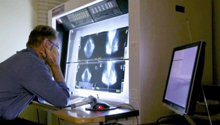 تقارير تؤكد ارتفاع الطلب على أطباء الأشعة رغم تطور الذكاء الاصطناعي